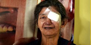 Fotografía de un paciente después de su cirugía de catarata, donada el día mundial de la visión
